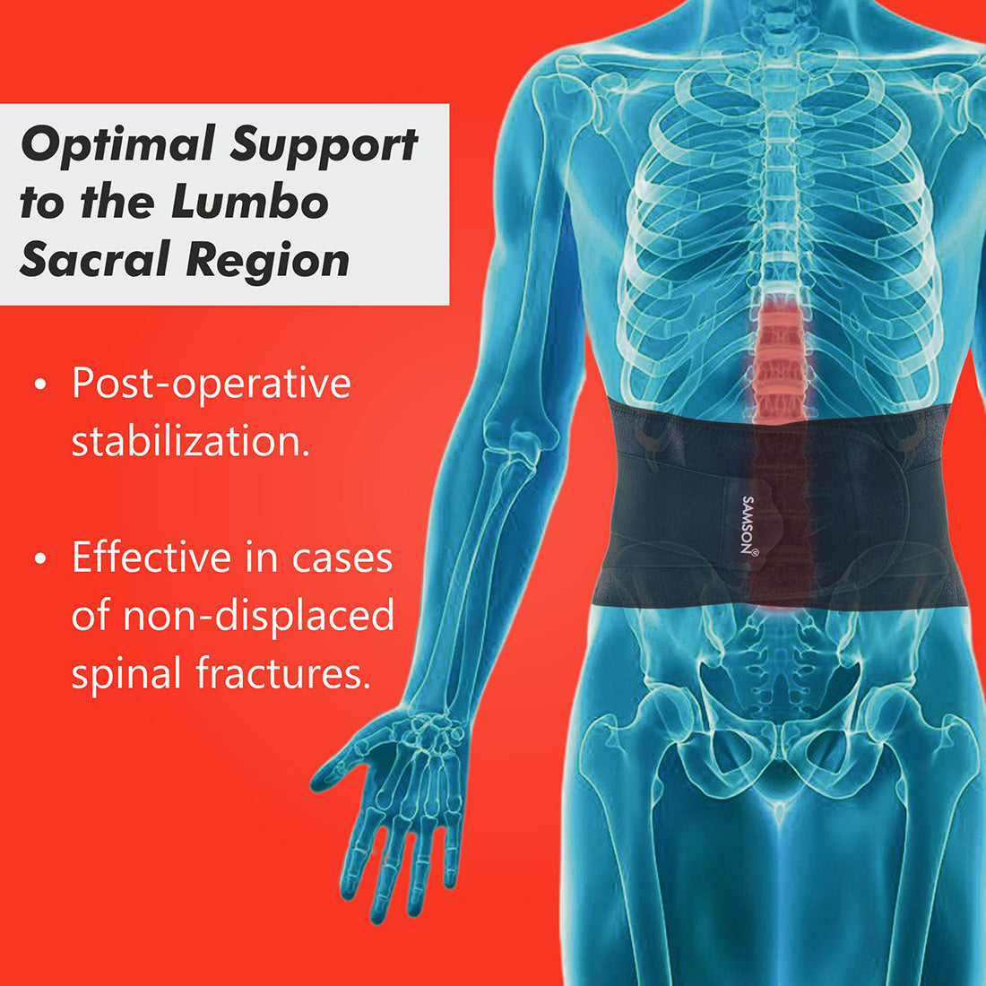 Samson Lumbo Sacral Belt (Lumbomed)
