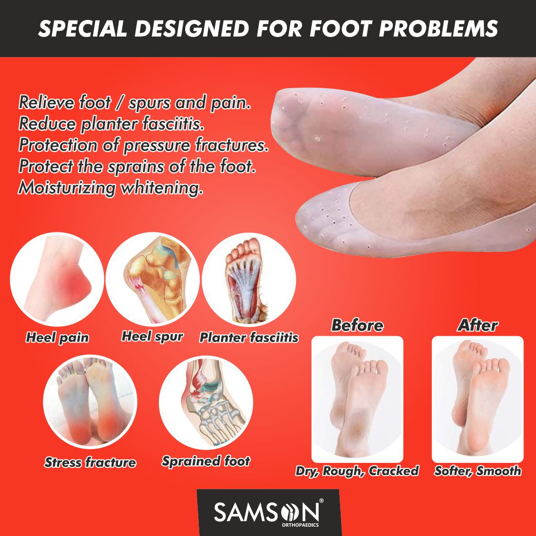Samson Silicone Socks (Pair)