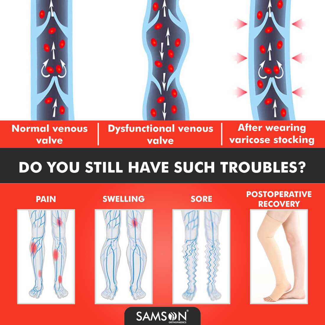 Samson - Varicose Vein Stockings Below Knee Classic (Pair)