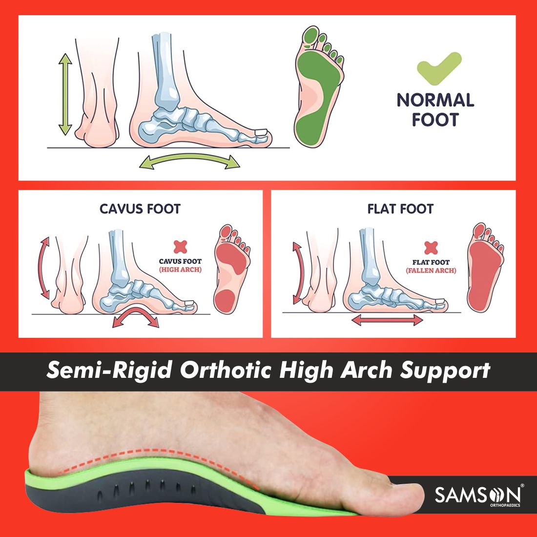 Samson 3/4 Orthotic Insole with Arch Support