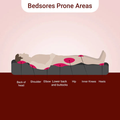 Soreze Advance Gel - For Treatment of Grade 1  & Grade 2 Bedsores
