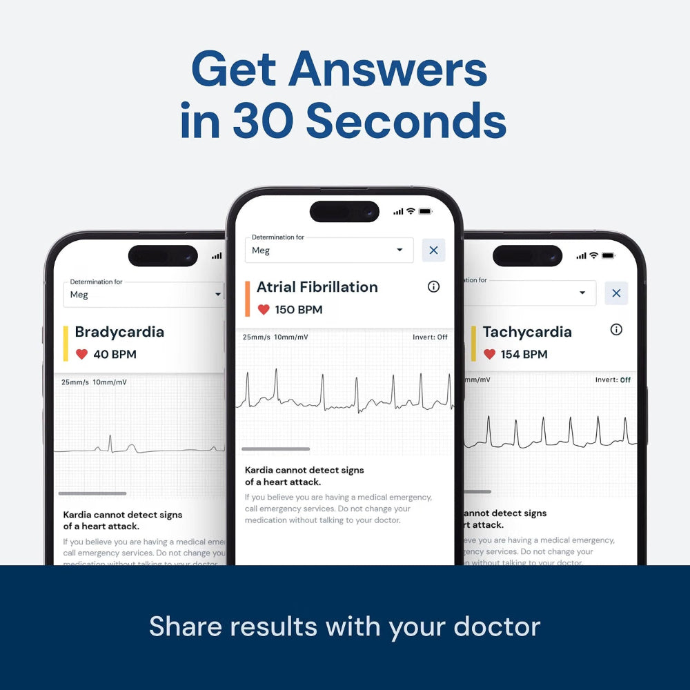 Alivecor KardiaMobile