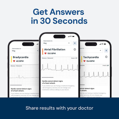 Alivecor KardiaMobile