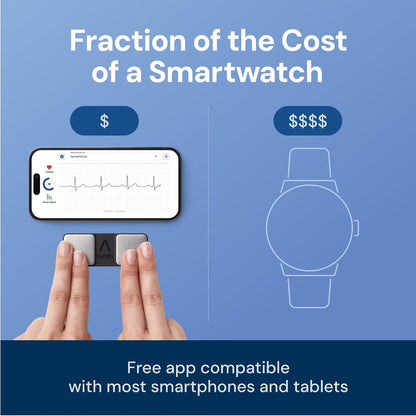 Alivecor KardiaMobile